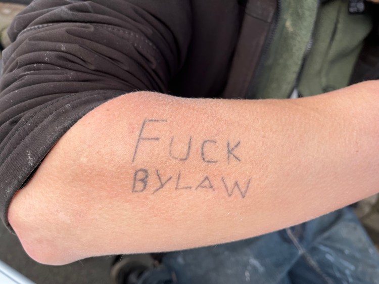 fuck bylaw written on a person's forearm in ink